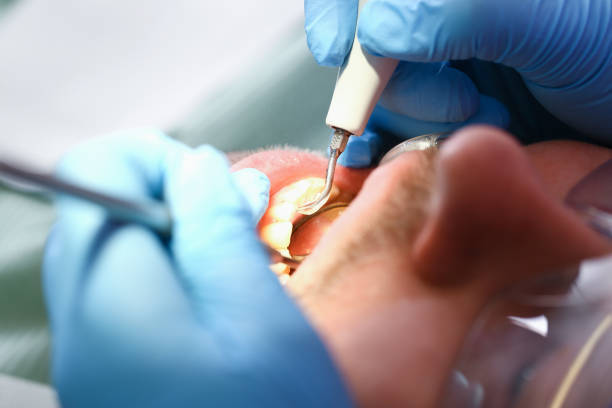 Best Pediatric Emergency Dentist in Woodmont, CT
