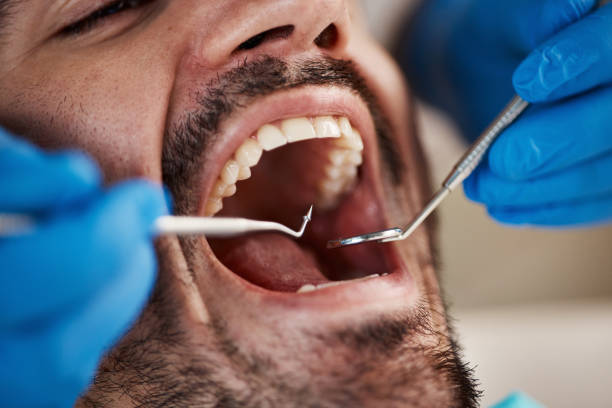 Best Mobile Emergency Dentist in Woodmont, CT
